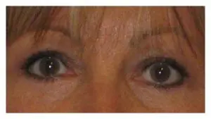Before & After Pictures in St. Augustine, FL 