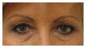 Before & After Pictures in St. Augustine, FL 