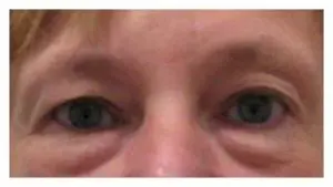 Before & After Pictures in St. Augustine, FL 