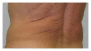 Before & After Pictures in St. Augustine, FL 