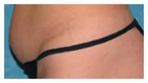 Before & After Pictures in St. Augustine, FL 