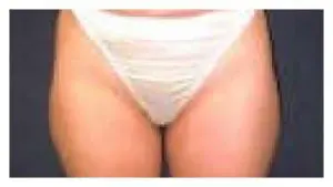 Before & After Pictures in St. Augustine, FL 