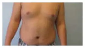 Before & After Pictures in St. Augustine, FL 