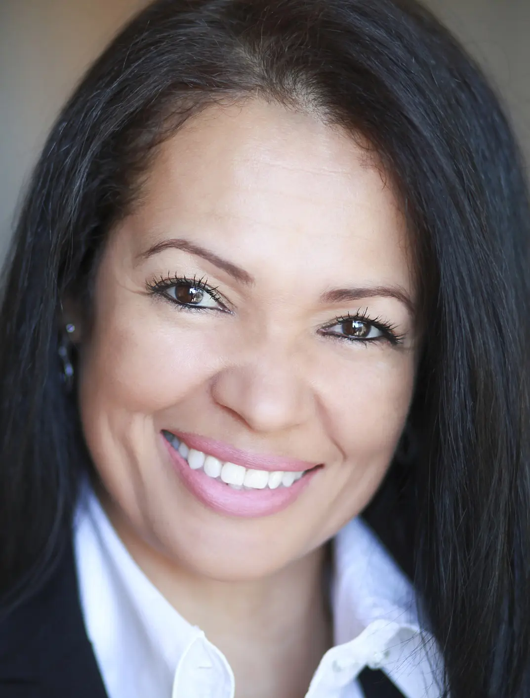 IPL™ Photofacial in St. Augustine, FL