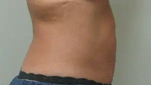 Before & After Pictures in St. Augustine, FL 