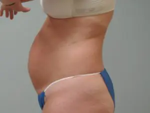 Before & After Pictures in St. Augustine, FL 