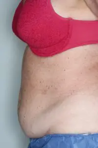 Before & After Pictures in St. Augustine, FL 