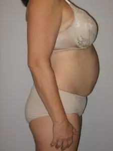 Before & After Pictures in St. Augustine, FL 